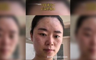 勇敢前行，共同战疫（勇敢前行，共同战疫）