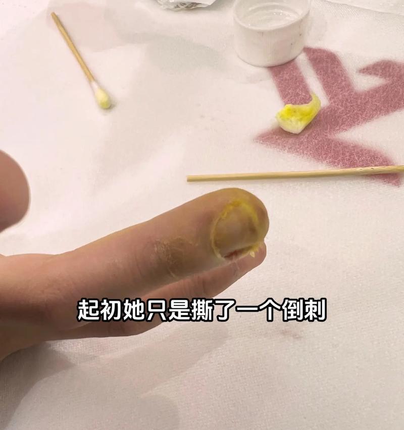 难忘的教训（经历失败，才能获得成功）-第1张图片-学作网